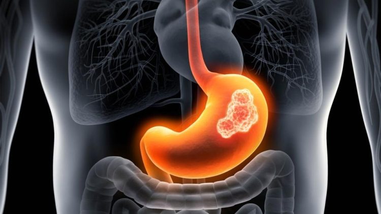 তালতলীতে বিষাক্ত ট্যাবলেট সেবনে নববধূর মৃত্যু!