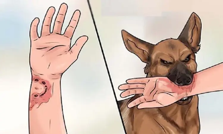 কলাপাড়ায় কুকুরের কামড়ে ৩৫ জন আহত, মিলছে না ভ্যাকসিন