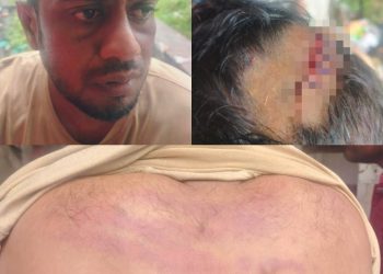 রামপালে দুর্বৃত্তদের হামলায় যুবক গুরুতর আহত, সুষ্ঠু তদন্তের দাবি স্বজনদের