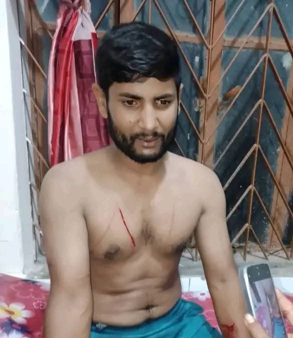 দুমকিতে গাড়িচালককে কুপিয়ে জখম করল দুর্বৃত্তরা, হাসপাতালে ভর্তি