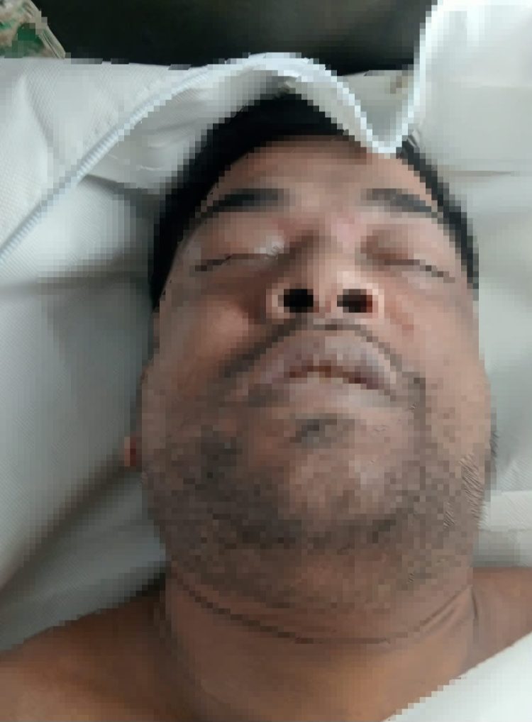 দশমিনায় কবিরাজের পুকুরের পাড় থেকে ভারসাম্যহীন ব্যক্তির মরদেহ উদ্ধার