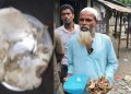 দুমকিতে ‘স্বপ্নে পাওয়া ফুল’ দিয়ে চিকিৎসার দাবি, রোগী সমাগমে চাঞ্চল্য